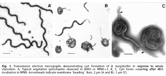 Borrelia-cysts Borrelia-cysts