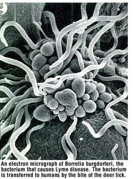 Borrelia